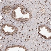 Anti-ZNF503 antibody produced in rabbit Prestige Antibodies&#174; Powered by Atlas Antibodies, affinity isolated antibody, buffered aqueous glycerol solution