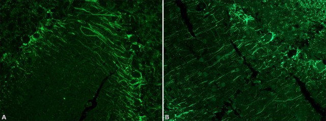 Anti-Neurofilament 200 antibody produced in rabbit IgG fraction of antiserum, buffered aqueous solution