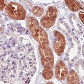 Monoclonal Anti-IDH1 antibody produced in mouse Prestige Antibodies&#174; Powered by Atlas Antibodies, clone CL0219, purified immunoglobulin, buffered aqueous glycerol solution
