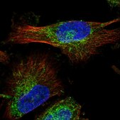 Anti-MAP7D1 antibody produced in rabbit Prestige Antibodies&#174; Powered by Atlas Antibodies, affinity isolated antibody, buffered aqueous glycerol solution