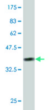 ANTI-RIPK4 antibody produced in mouse clone 4H5, purified immunoglobulin, buffered aqueous solution