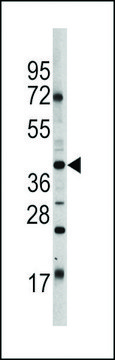 ANTI-OCT4 (OCT3) (E125) antibody produced in rabbit purified immunoglobulin, buffered aqueous solution