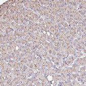 Anti-CAT antibody produced in rabbit Prestige Antibodies&#174; Powered by Atlas Antibodies, affinity isolated antibody, buffered aqueous glycerol solution