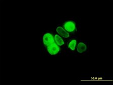 Monoclonal Anti-PGR antibody produced in mouse clone 5D10, purified immunoglobulin, buffered aqueous solution
