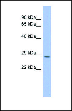 Anti-PSMB10 antibody produced in rabbit affinity isolated antibody