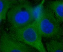 Anti-Nitrotyrosine antibody produced in rabbit affinity isolated antibody, buffered aqueous solution