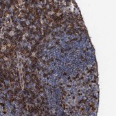 Anti-LCP2 antibody produced in rabbit Prestige Antibodies&#174; Powered by Atlas Antibodies, affinity isolated antibody, buffered aqueous glycerol solution