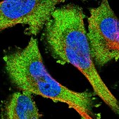 Anti-PRKD1 antibody produced in rabbit Prestige Antibodies&#174; Powered by Atlas Antibodies, affinity isolated antibody, buffered aqueous glycerol solution