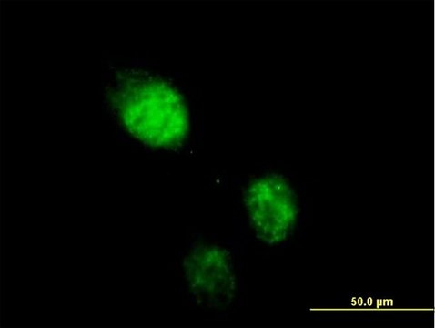 Anti-RAD23B antibody produced in mouse IgG fraction of antiserum, buffered aqueous solution