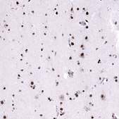 Monoclonal Anti-FOXM1 antibody produced in mouse Prestige Antibodies&#174; Powered by Atlas Antibodies, clone CL12131, purified immunoglobulin, buffered aqueous glycerol solution