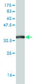 Monoclonal Anti-SLC19A2 antibody produced in mouse clone 5B10, purified immunoglobulin, buffered aqueous solution