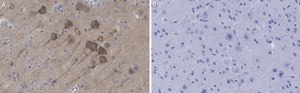 Anti-NMDAR2B Antibody, clone 5C18 ZooMAb&#174; Rabbit Monoclonal recombinant, expressed in HEK 293 cells