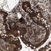 Anti-ATIC antibody produced in rabbit Prestige Antibodies&#174; Powered by Atlas Antibodies, affinity isolated antibody, buffered aqueous glycerol solution