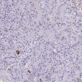 Anti-F2 antibody produced in rabbit Prestige Antibodies&#174; Powered by Atlas Antibodies, affinity isolated antibody, buffered aqueous glycerol solution