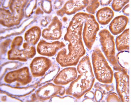 Anti-PI3 Kinase Antibody, p110&#946; from rabbit, purified by affinity chromatography