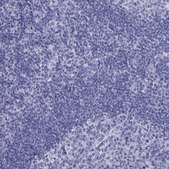 Anti-TFF3 antibody produced in rabbit Prestige Antibodies&#174; Powered by Atlas Antibodies, affinity isolated antibody, buffered aqueous glycerol solution