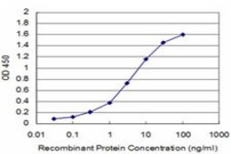 Monoclonal Anti-HDAC9 antibody produced in mouse clone 2G10, purified immunoglobulin, buffered aqueous solution
