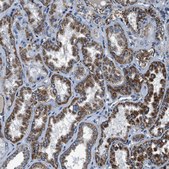 Anti-OGDH antibody produced in rabbit Prestige Antibodies&#174; Powered by Atlas Antibodies, affinity isolated antibody, buffered aqueous glycerol solution