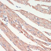 Anti-LRRK2 antibody produced in rabbit