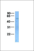 Anti-SLC22A11 (AB1) antibody produced in rabbit affinity isolated antibody
