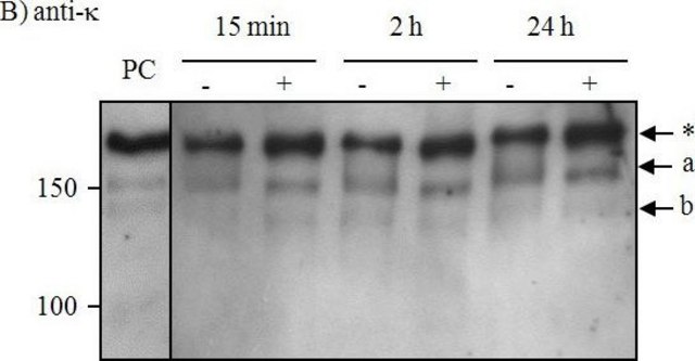 Anti-Human Kappa Light Chains (Bound and Free)&#8722;Peroxidase antibody produced in goat affinity isolated antibody, buffered aqueous solution