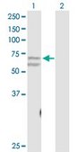 Anti-CACNB3 antibody produced in rabbit purified immunoglobulin, buffered aqueous solution