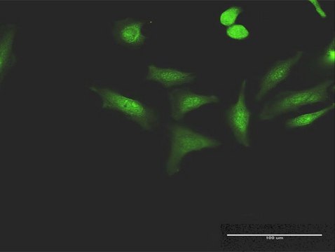 Anti-CCNT1 antibody produced in mouse purified immunoglobulin, buffered aqueous solution