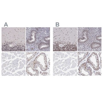 Anti-ADAR antibody produced in rabbit Prestige Antibodies&#174; Powered by Atlas Antibodies, affinity isolated antibody, buffered aqueous glycerol solution