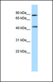 Anti-RARG antibody produced in rabbit affinity isolated antibody