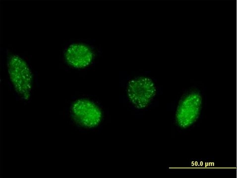 Anti-VIM antibody produced in mouse purified immunoglobulin, buffered aqueous solution