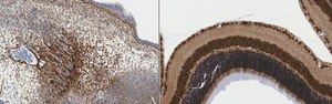 Anti-RalDH2 (ALDH1A2) from rabbit, purified by affinity chromatography