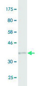 Monoclonal Anti-PARP1, (N-terminal) antibody produced in mouse clone 2C7, purified immunoglobulin, buffered aqueous solution