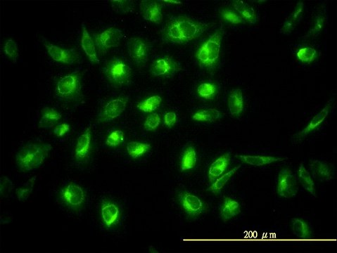 Monoclonal Anti-COG7 antibody produced in mouse clone 3G4-1B3, purified immunoglobulin, buffered aqueous solution