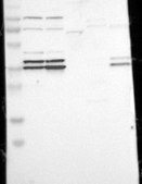 Anti-CDK7 antibody produced in rabbit Prestige Antibodies&#174; Powered by Atlas Antibodies, affinity isolated antibody, buffered aqueous glycerol solution