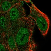 Anti-SLC9A4 antibody produced in rabbit Prestige Antibodies&#174; Powered by Atlas Antibodies, affinity isolated antibody, buffered aqueous glycerol solution
