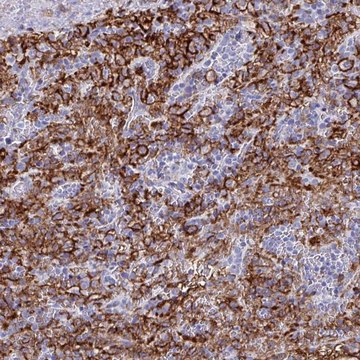 Anti-FCGR3A antibody produced in rabbit Prestige Antibodies&#174; Powered by Atlas Antibodies, affinity isolated antibody, buffered aqueous glycerol solution