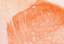 Anti-Vanilloid Receptor Like Protein 1 Antibody, pain, CT serum, Chemicon&#174;