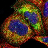 Anti-OAS1 antibody produced in rabbit Prestige Antibodies&#174; Powered by Atlas Antibodies, affinity isolated antibody, buffered aqueous glycerol solution