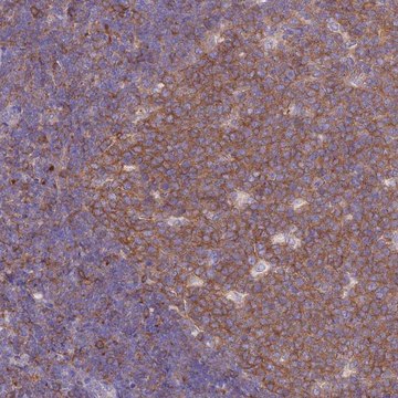 Anti-NAMPT antibody produced in rabbit Prestige Antibodies&#174; Powered by Atlas Antibodies, affinity isolated antibody, buffered aqueous glycerol solution