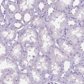 Anti-MMP9 antibody produced in rabbit affinity isolated antibody, buffered aqueous glycerol solution