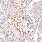 Monoclonal Anti-Cdk19 Antibody Produced In Mouse Prestige Antibodies&#174; Powered by Atlas Antibodies, clone CL14116, affinity isolated antibody, buffered aqueous glycerol solution