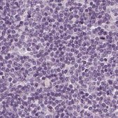 Anti-BFSP1 antibody produced in rabbit Prestige Antibodies&#174; Powered by Atlas Antibodies, affinity isolated antibody, buffered aqueous glycerol solution