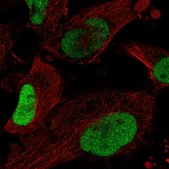 Anti-SOX2 antibody produced in rabbit Prestige Antibodies&#174; Powered by Atlas Antibodies, affinity isolated antibody