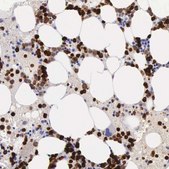 Anti-FCN1 antibody produced in rabbit Ab1, Prestige Antibodies&#174; Powered by Atlas Antibodies, affinity isolated antibody, buffered aqueous glycerol solution