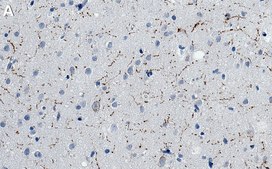Anti-Neuropeptide Y Antibody, clone 2B5 ZooMAb&#174; Rabbit Monoclonal recombinant, expressed in HEK 293 cells