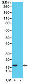 Anti-Gamma H2AX (phospho-Ser139) antibody, Rabbit monoclonal recombinant, expressed in HEK 293 cells, clone RM224, purified immunoglobulin