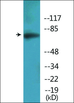 Anti-phospho-Artemis (pSer516) antibody produced in rabbit affinity isolated antibody
