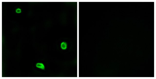 Anti-PAR4 antibody produced in rabbit affinity isolated antibody