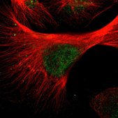 Anti-WTAP antibody produced in rabbit Prestige Antibodies&#174; Powered by Atlas Antibodies, affinity isolated antibody, buffered aqueous glycerol solution