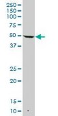 Anti-KRT7 antibody produced in mouse purified immunoglobulin, buffered aqueous solution